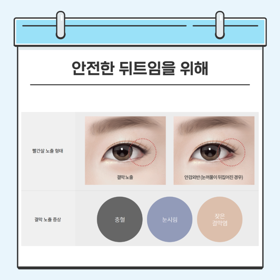 밑트임수술 안전하게 할 수 있는 방법 관련 이미지 5
