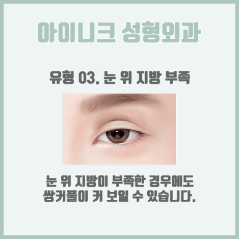 쌍커플재수술비용 원인별 맞춤 솔루션 제공! 관련 이미지 6