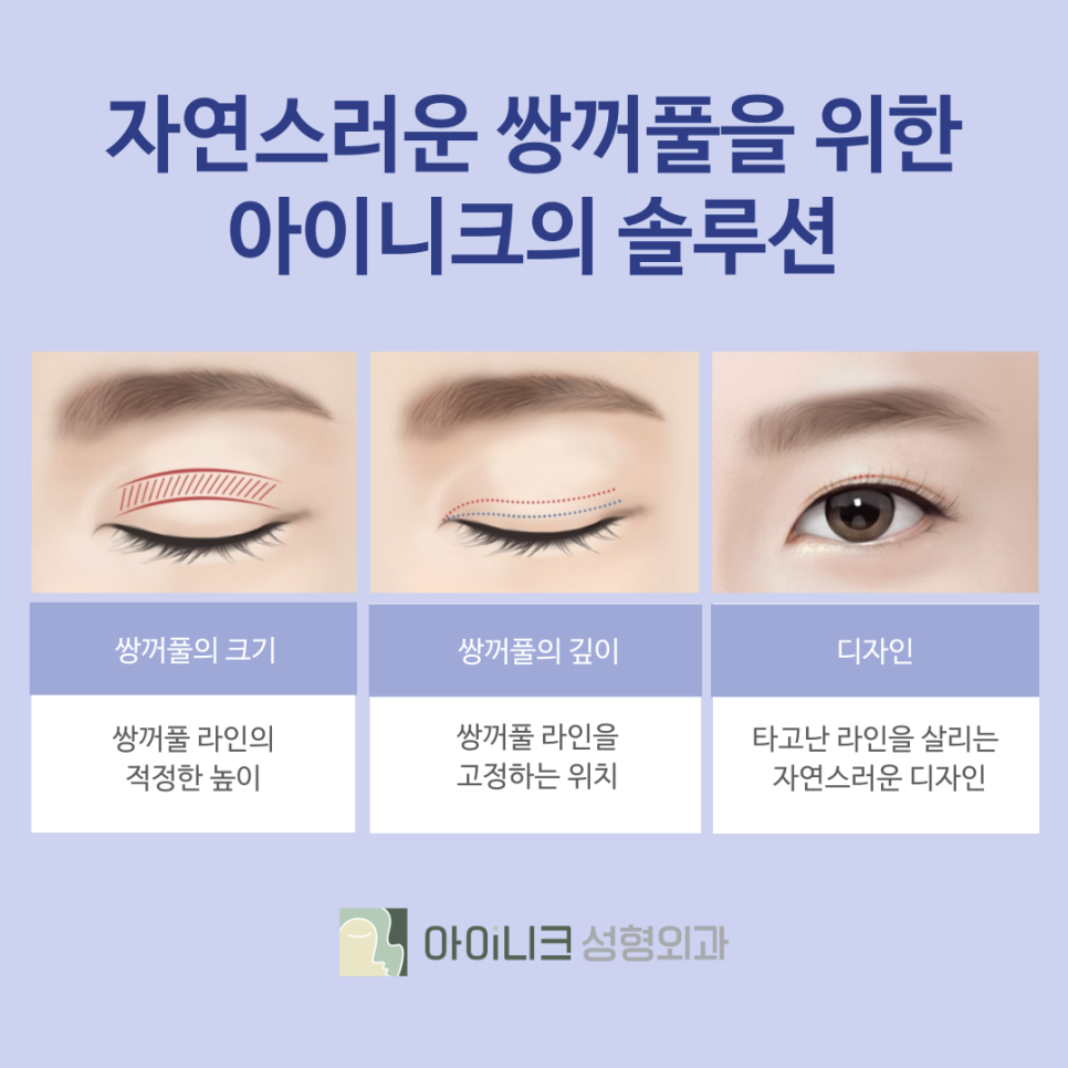 강남성형외과 아이니크의 자연스럽고 예쁜 쌍꺼풀 관련 이미지 5