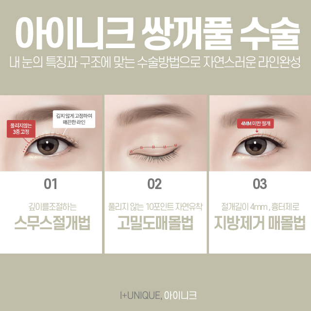 가로수길성형외과 아이니크에서 마음에 드는 눈 수술을! 관련 이미지 3