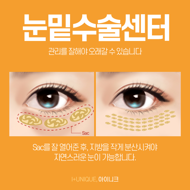 눈밑수술센터 수술 후 회복할 때 주의할점 관련 이미지 4