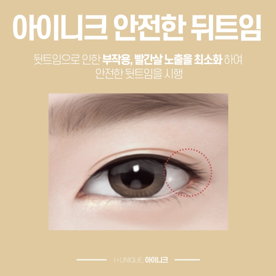 서울뒤트임 잘하는 곳을 찾고 있다면 아이니크성형외과 관련 이미지 3