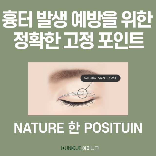 쌍꺼풀수술 흉터, 아이니크가 책임질게! 관련 이미지 3