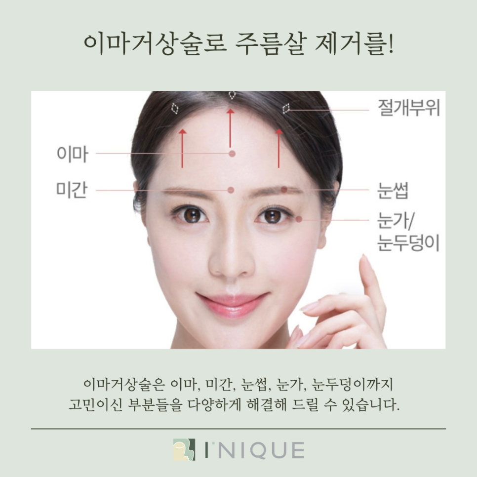 주름살제거, 어떻게 할까요? 관련 이미지 3