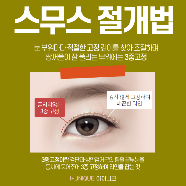 눈수술전문병원 I + Unique 아이니크 관련 이미지 3