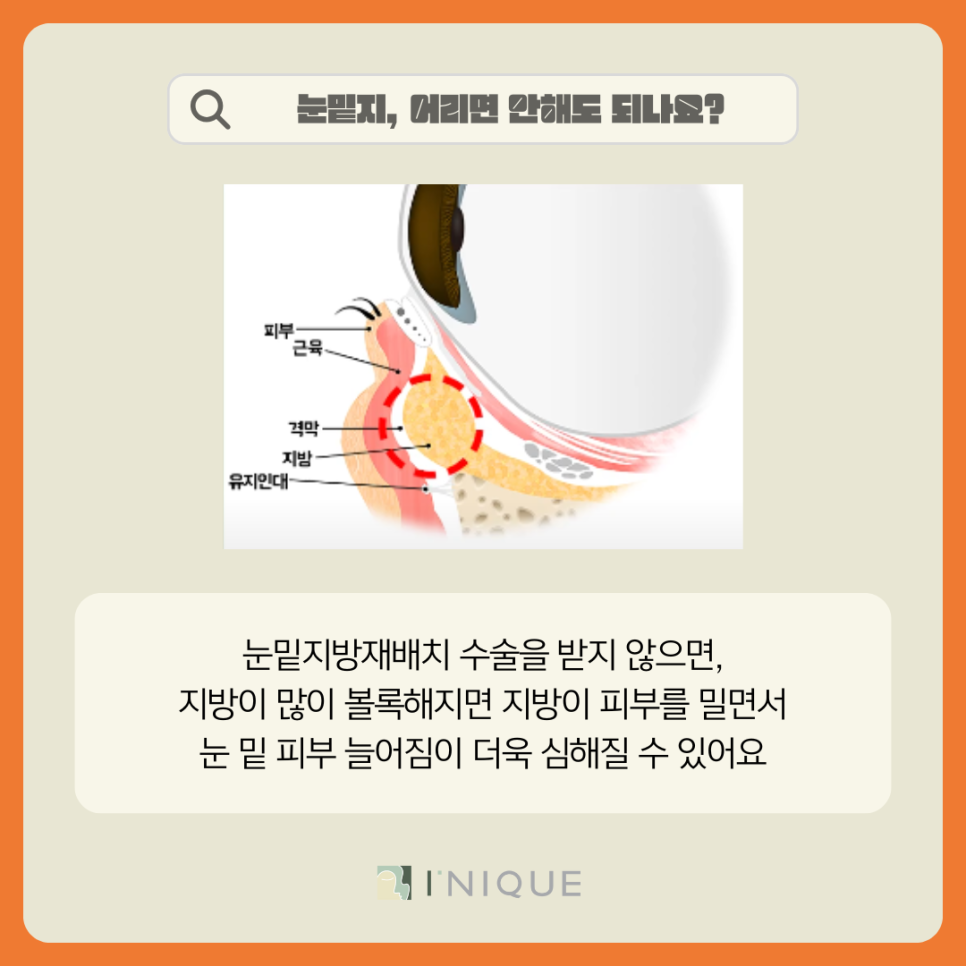 압구정 앙코르눈밑지 적정 연령은? 관련 이미지 6
