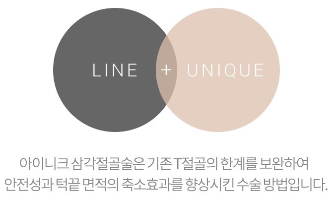 턱끝축소술비용 보다 절골법이 먼저! 관련 이미지 6