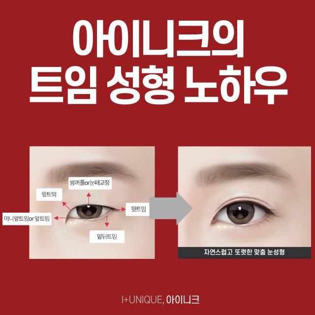 또렷하고 긴 눈매를 원하는 남자분들, 밑트임보다 밑뒤트임을 추천드립니다! 관련 이미지 2