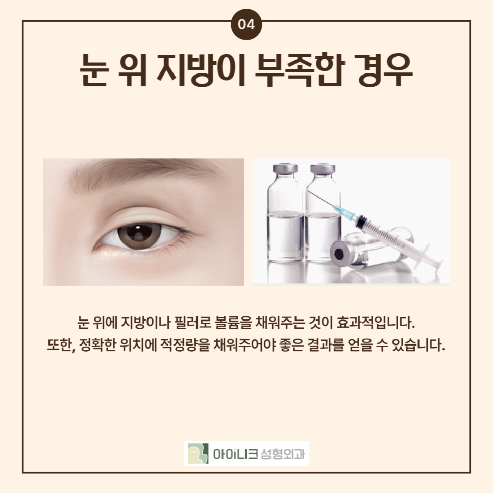 If You’re Looking for a Place That Specializes in Revision Eyelid Surgery, Take Note! image 5