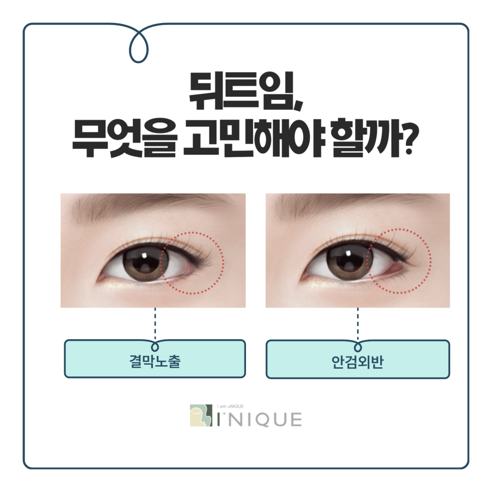 뒤트임잘하는곳 만의 특별함 관련 이미지 5