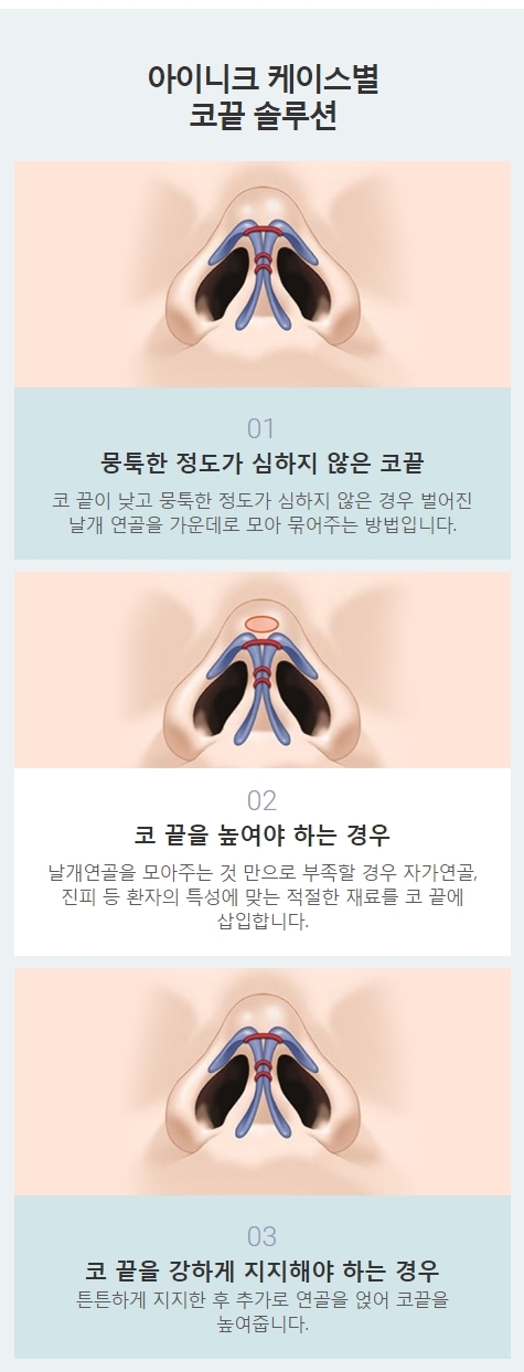 코끝연골묶기가격 정확한 수술로 보답하는 아이니크! 관련 이미지 4