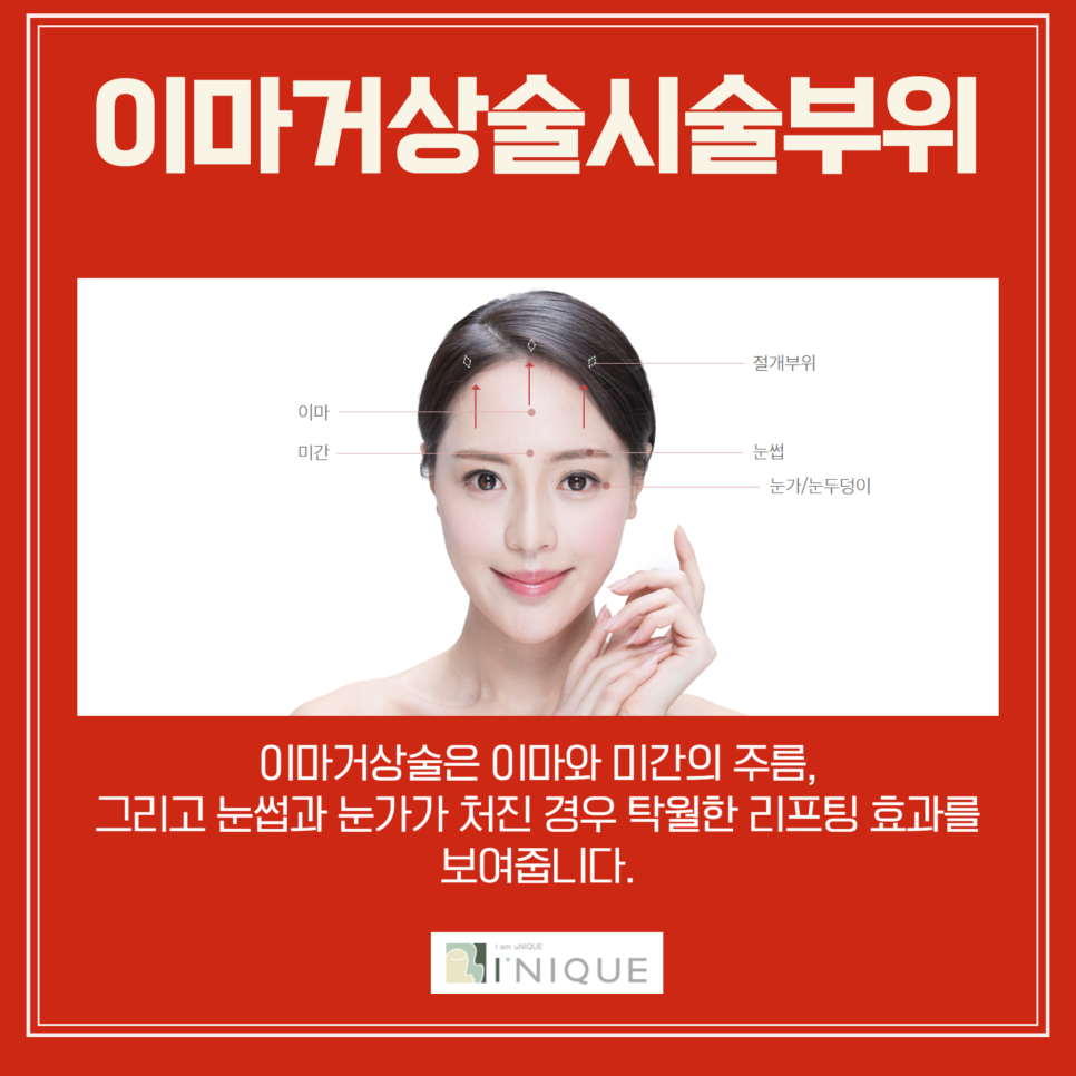 If You Want to Remove Forehead Wrinkles Properly image 5