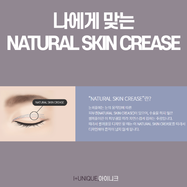 여자눈성형종류 나에게 맞는 방법은? 관련 이미지 4