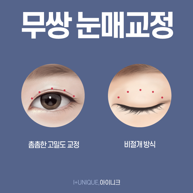 남자쌍수가격이 고민된다면? 관련 이미지 5