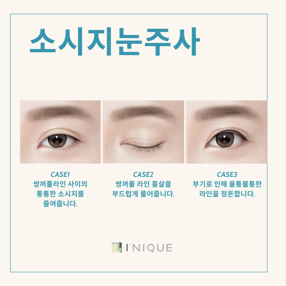 If You’re Considering Double Eyelid Revision Surgery in Seoul image 5