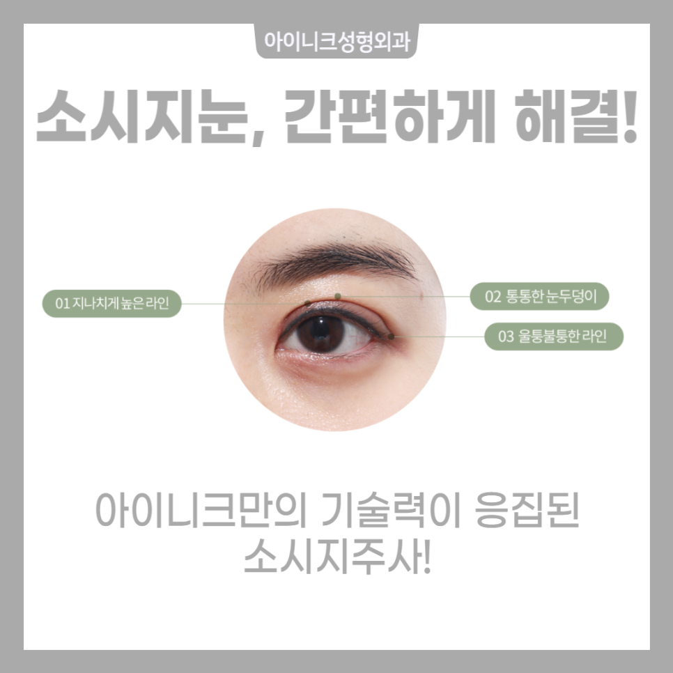쌍수붓기주사로 간편하게 해결! 관련 이미지 6