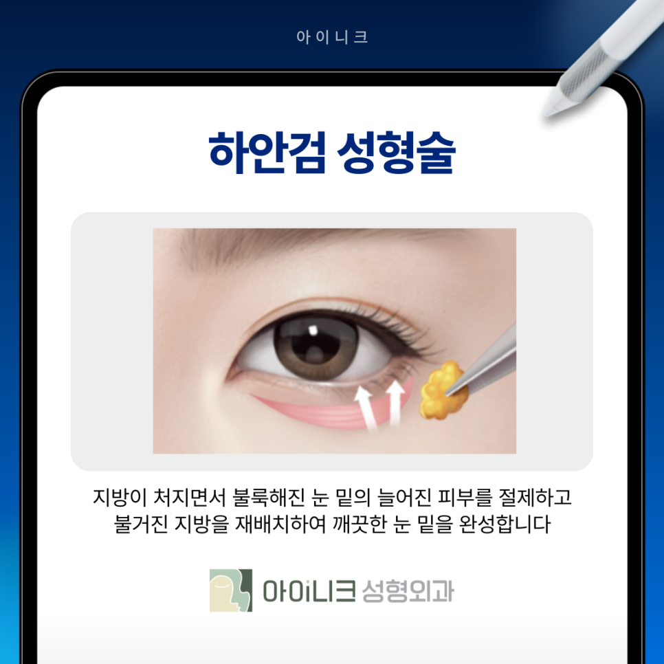 눈밑처짐 해결로 자연스러운 동안 만들기 관련 이미지 11