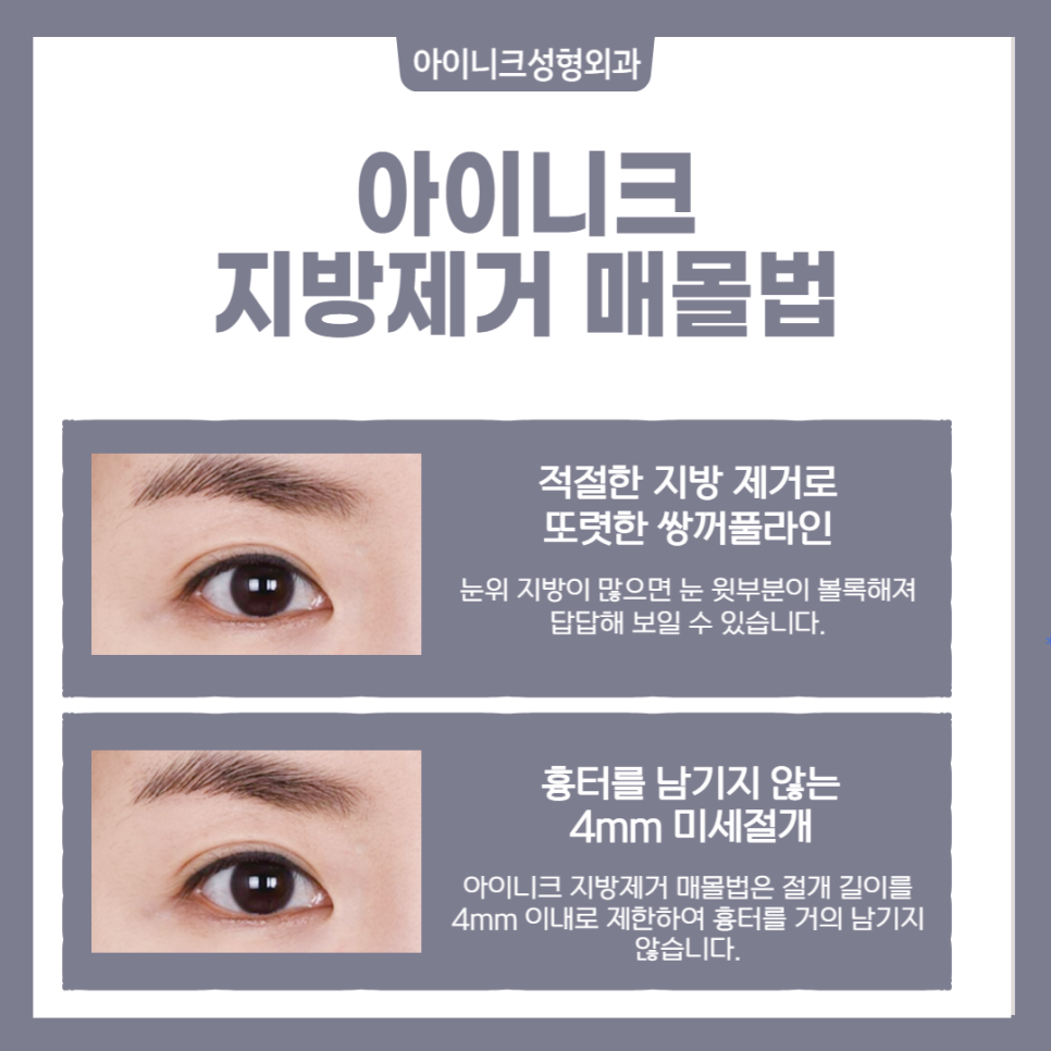 What Makes a Great Double Eyelid Surgery Clinic in Seoul Different! image 6