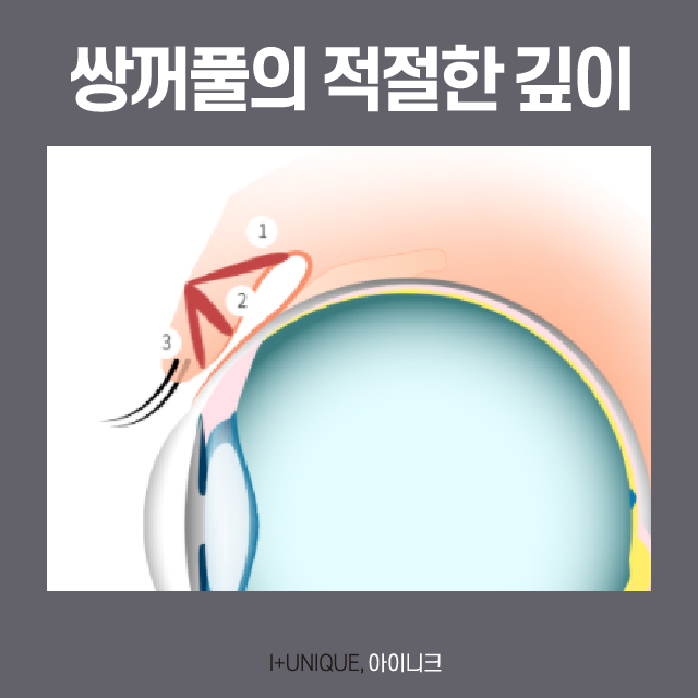 자연스러운 쌍꺼풀 만드는 비법은? 관련 이미지 3