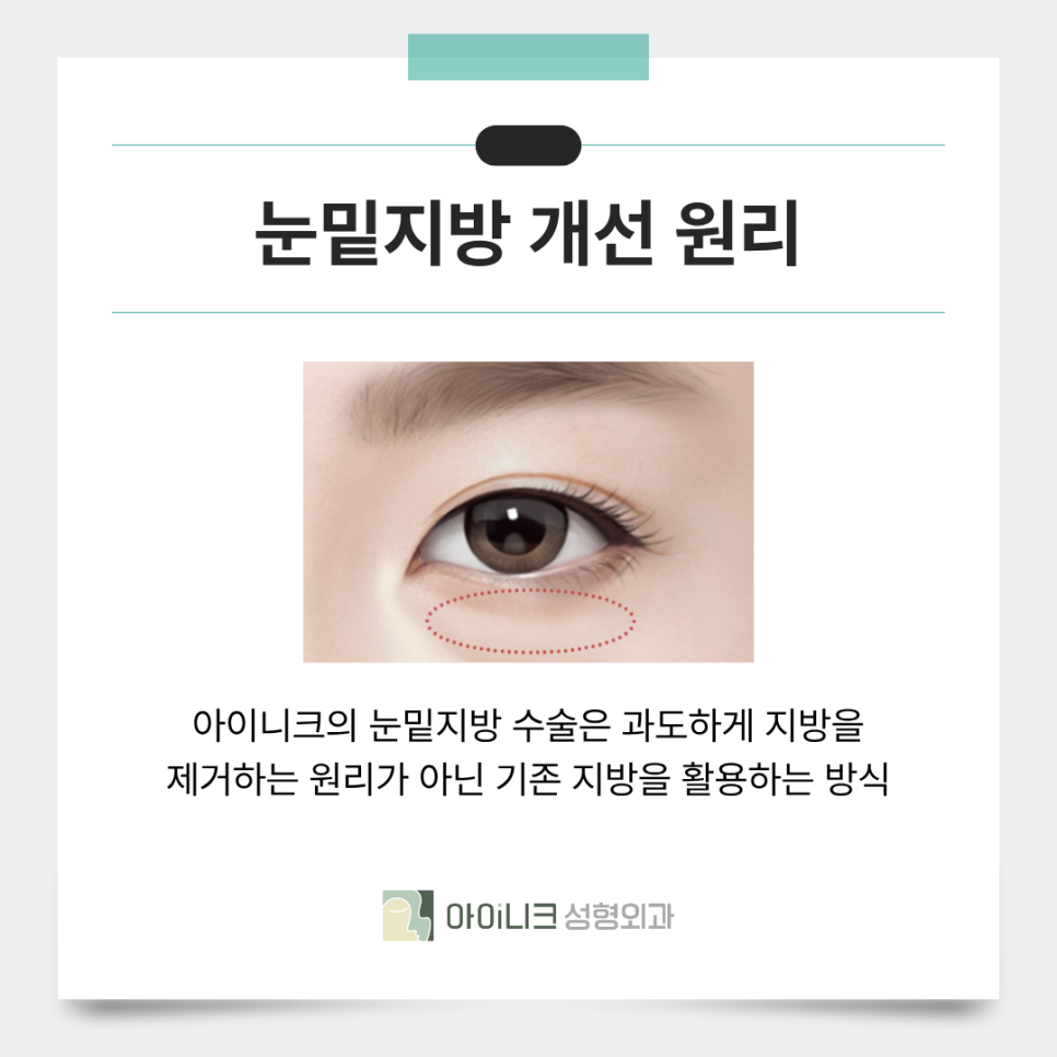 Under-Eye Fat Removal Laser: Eliminating Facial Shadows image 3