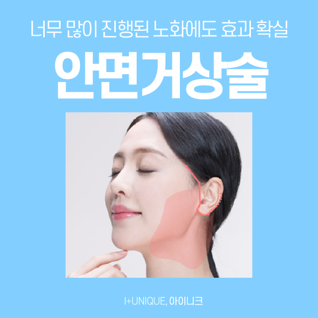 Finding the Right Revision Facelift Method for Me, from the Face to Under the Chin image 2