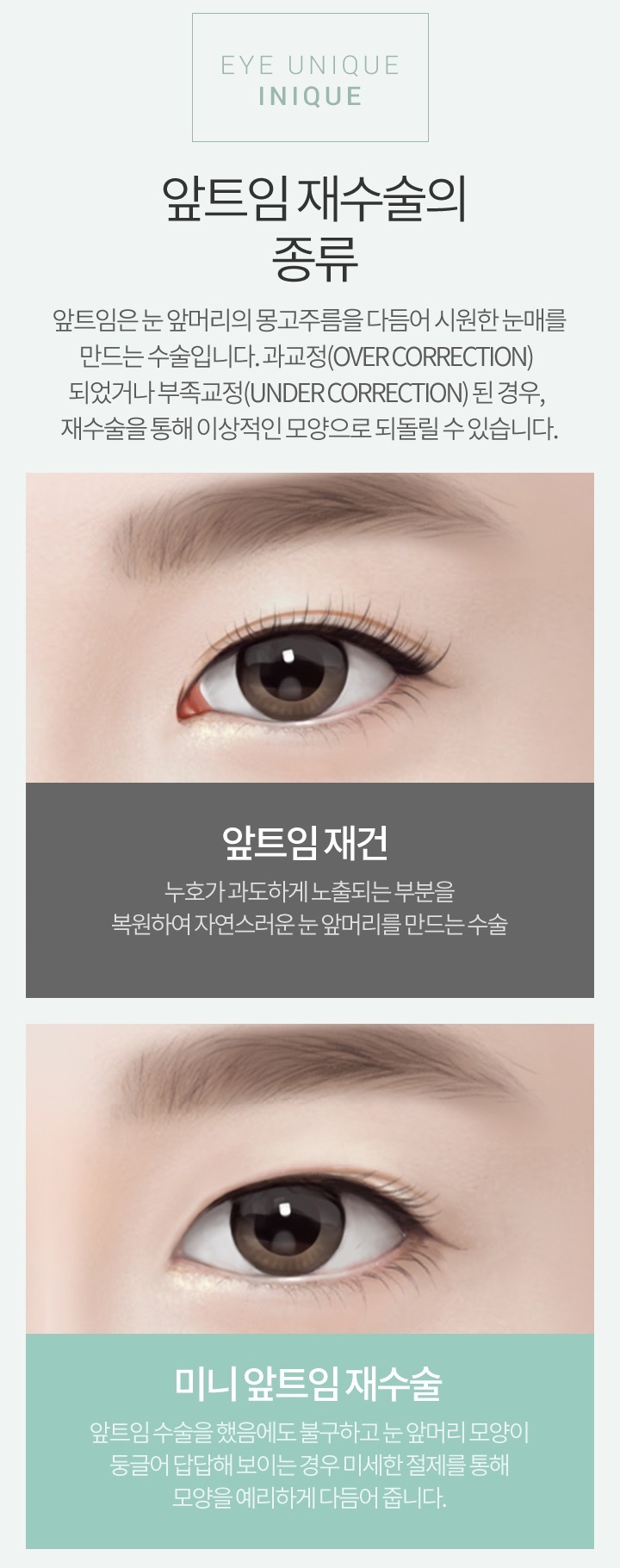 앞트임복원가격 걱정 없는 아이 니크! 관련 이미지 2
