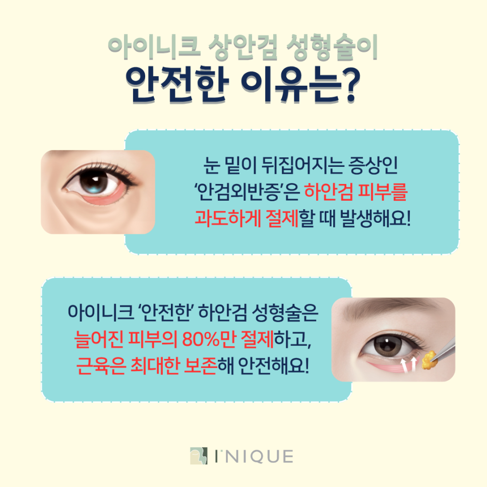 Mature Eye Reoperation Plastic Surgery: High Satisfaction from the First Surgery image 7