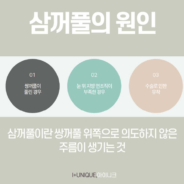 삼꺼풀 해결방법 궁금하다면? 관련 이미지 2