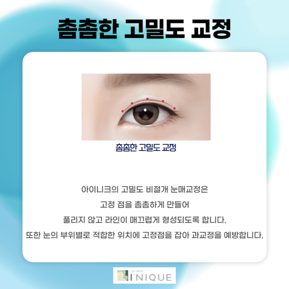 강남남자눈성형 부담스럽지 않은 또렷한 인상으로 관련 이미지 5
