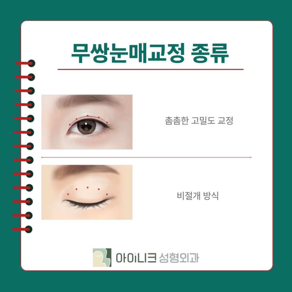 The Best Place for Male Eye Surgery: Natural Results Without Looking Obvious image 10