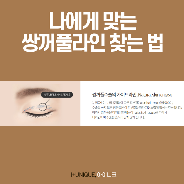 쌍꺼풀 재수술 방법 바로 알고 선택하자! 관련 이미지 3