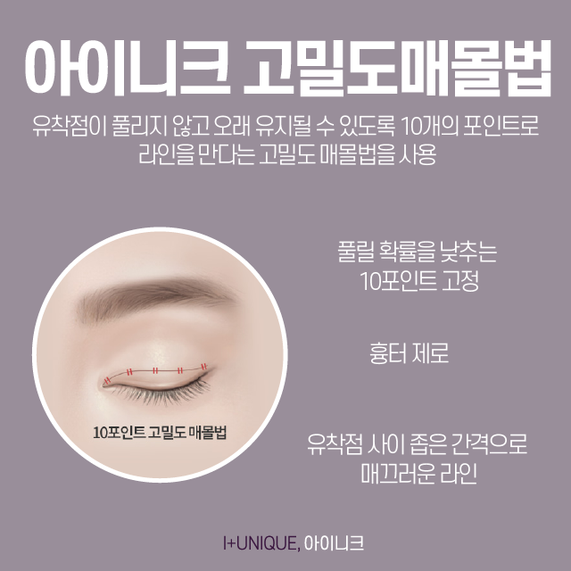 쌍커풀수술잘하는병원에서 하는 방법은 뭔가 다르다! 관련 이미지 5