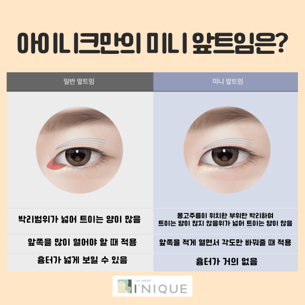 Eyelid Corner Surgery: Natural Results Are Essential! image 3