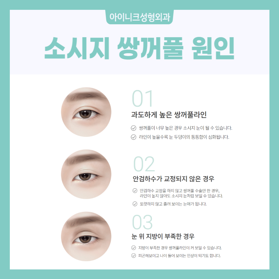 쌍꺼풀 붓기 도움을 원한다면? 관련 이미지 6
