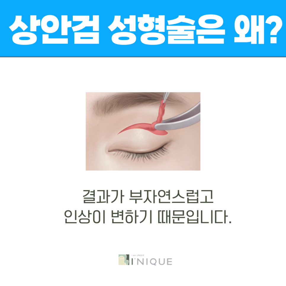 중년성형외과 안전함과 완성도를 갖춘 이곳 관련 이미지 5