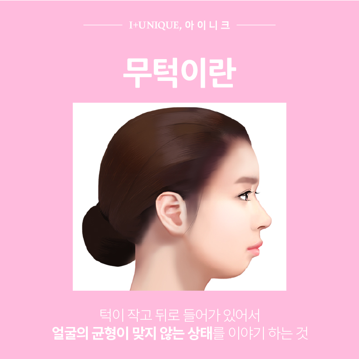 턱이 없다구요?! ㅇㅇㄴㅋ 무턱 3가지 해결방법 관련 이미지 2