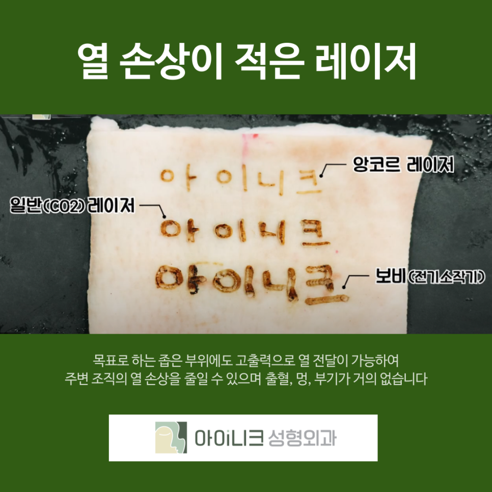 압구정역 눈밑 지방 재배치 후기 성공하는 방법 관련 이미지 7