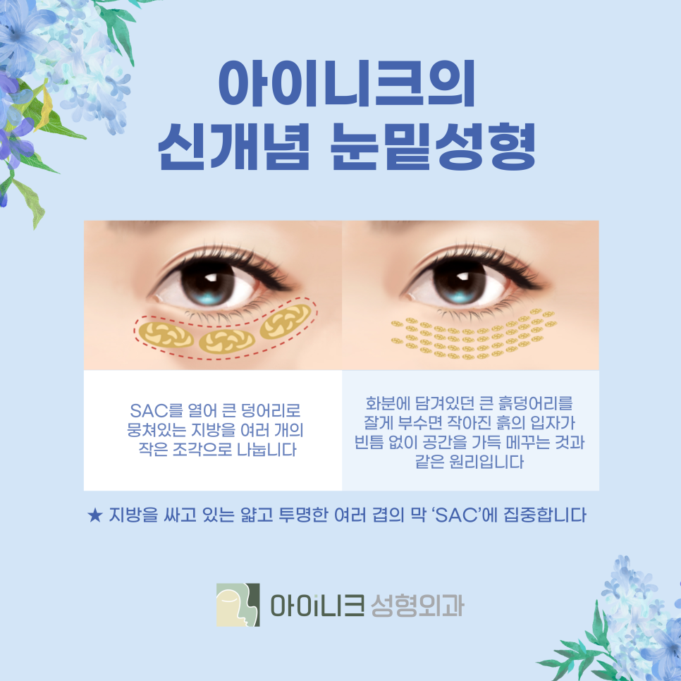 Performing Lower Eyelid Plastic Surgery with a New Approach image 4