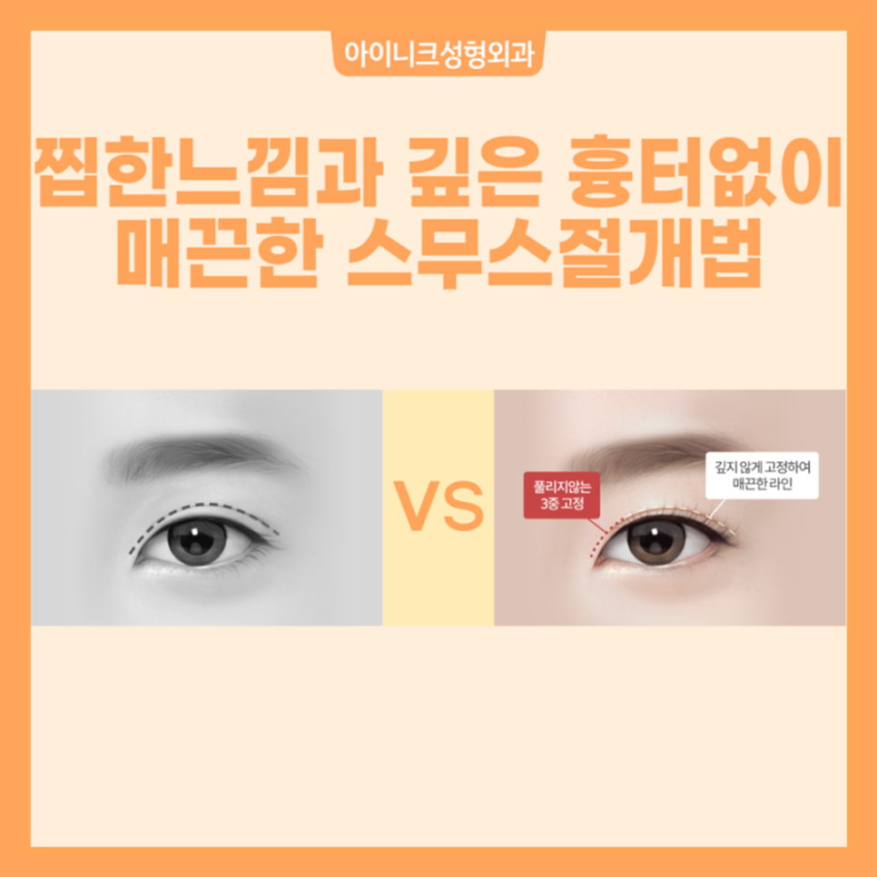 안전한 쌍수수술은 아이니크성형외과 관련 이미지 4