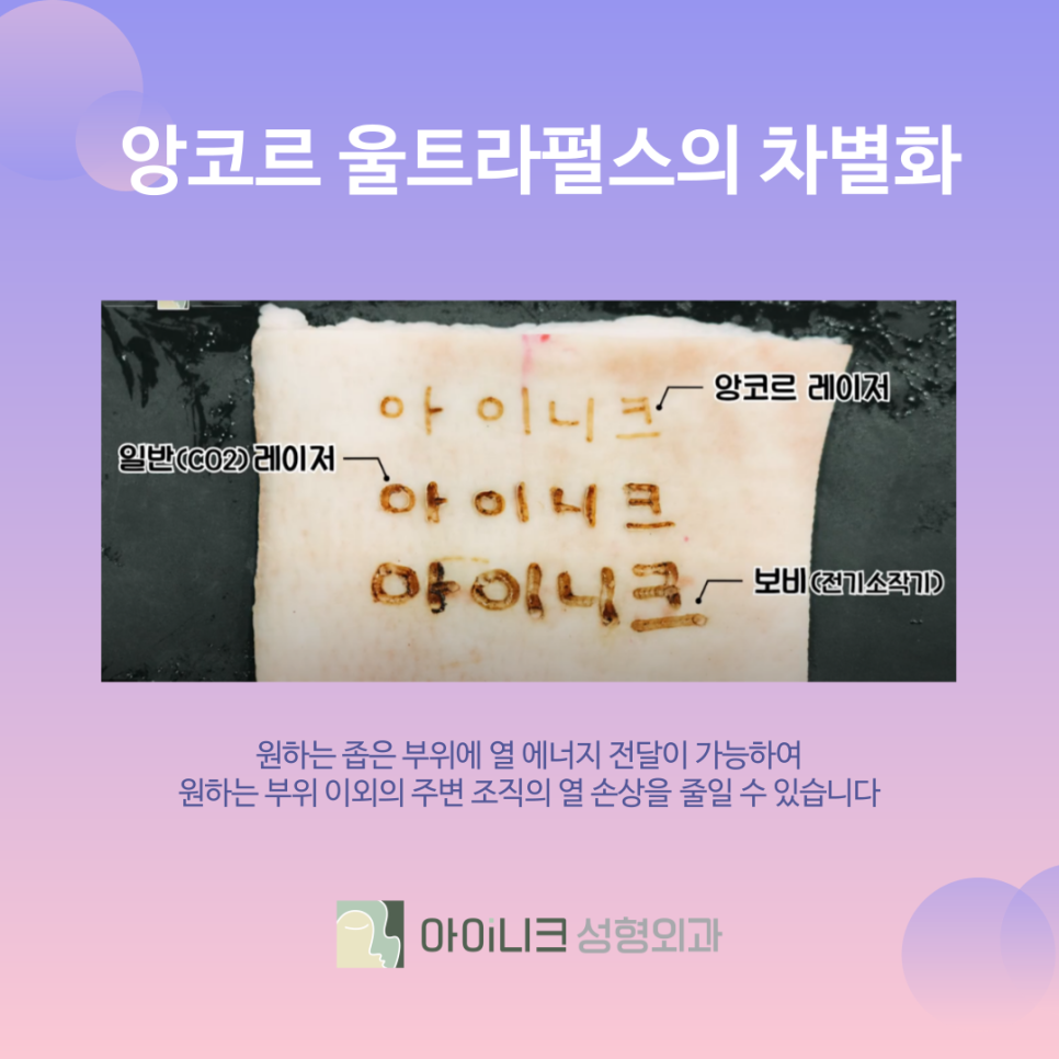 눈밑지방재배치 10년은 더 젊어 보이게 관련 이미지 5