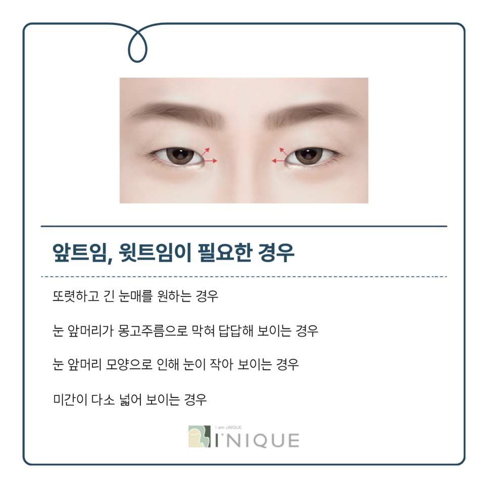 뒤트임잘하는곳 만의 특별함 관련 이미지 4
