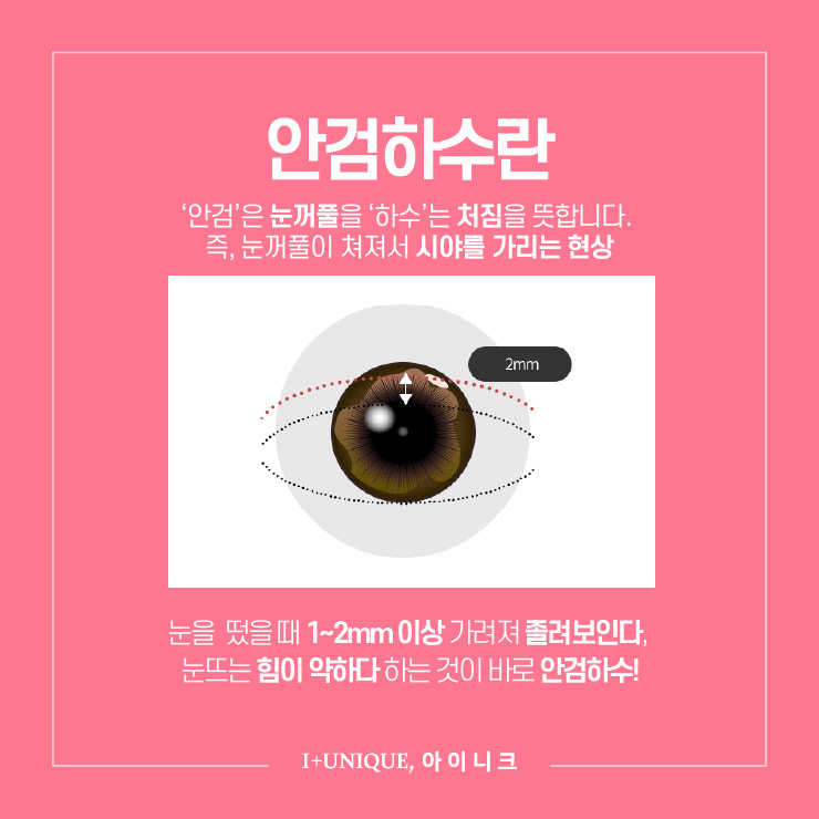 졸린 눈 성형 잘하는 병원 ㅇㅇㄴㅋ 관련 이미지 2