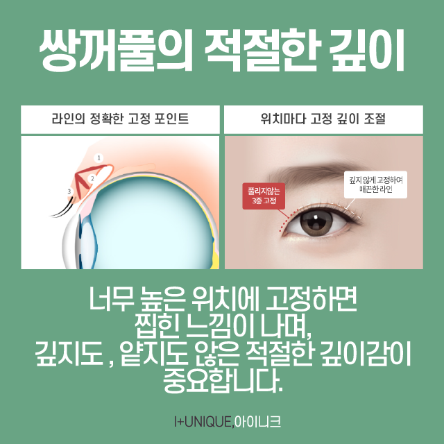 쌍꺼풀수술, 나만을 위한 디자인을 원한다면? 관련 이미지 3