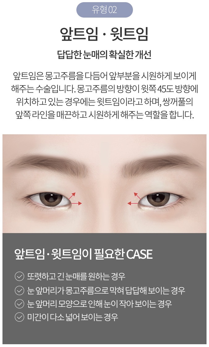 듀얼트임가격 맞춤 성형이 중요해~ 관련 이미지 5