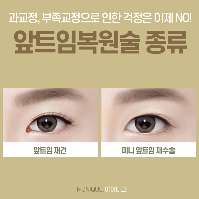 앞트임복원을 고민 중이라면 아이니크에서 가격까지 한 번에 상담받자! 관련 이미지 2
