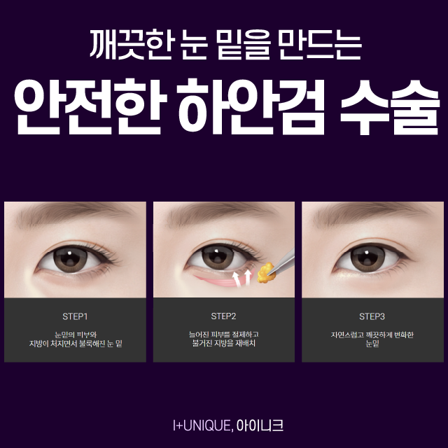 중년눈성형 강남 1위 병원 아이니크로 오세요! 관련 이미지 4