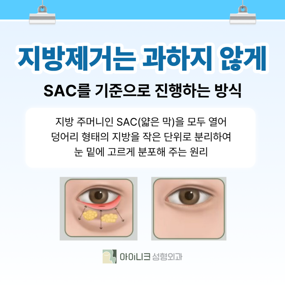 Recommended Under-Eye Fat Repositioning Clinic: Clear Improvement and Fast Recovery image 5