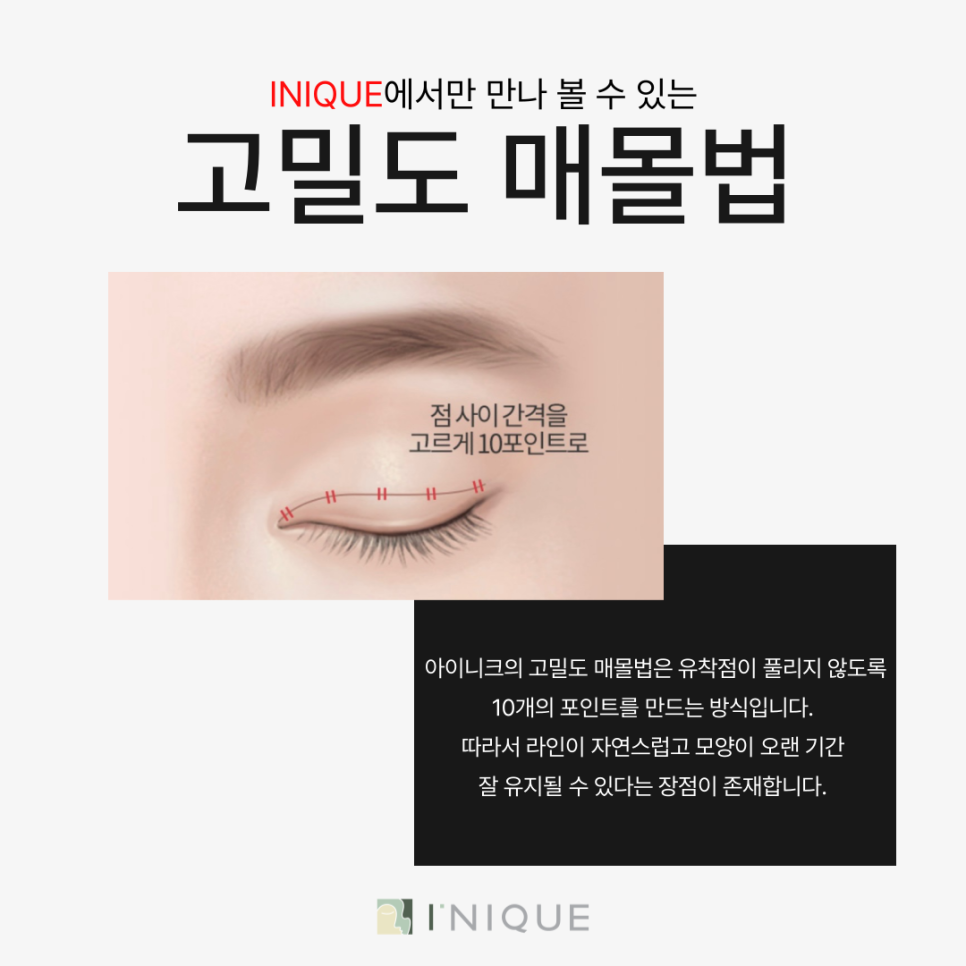안전한 쌍수병원추천받고 싶다면 관련 이미지 5