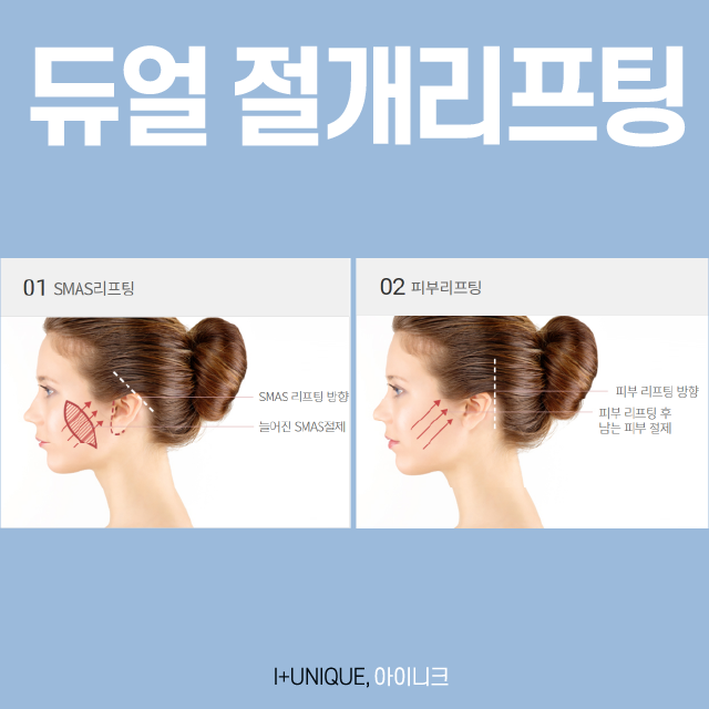 유지기간부터 회복기간까지 완벽한 안면거상술 관련 이미지 5