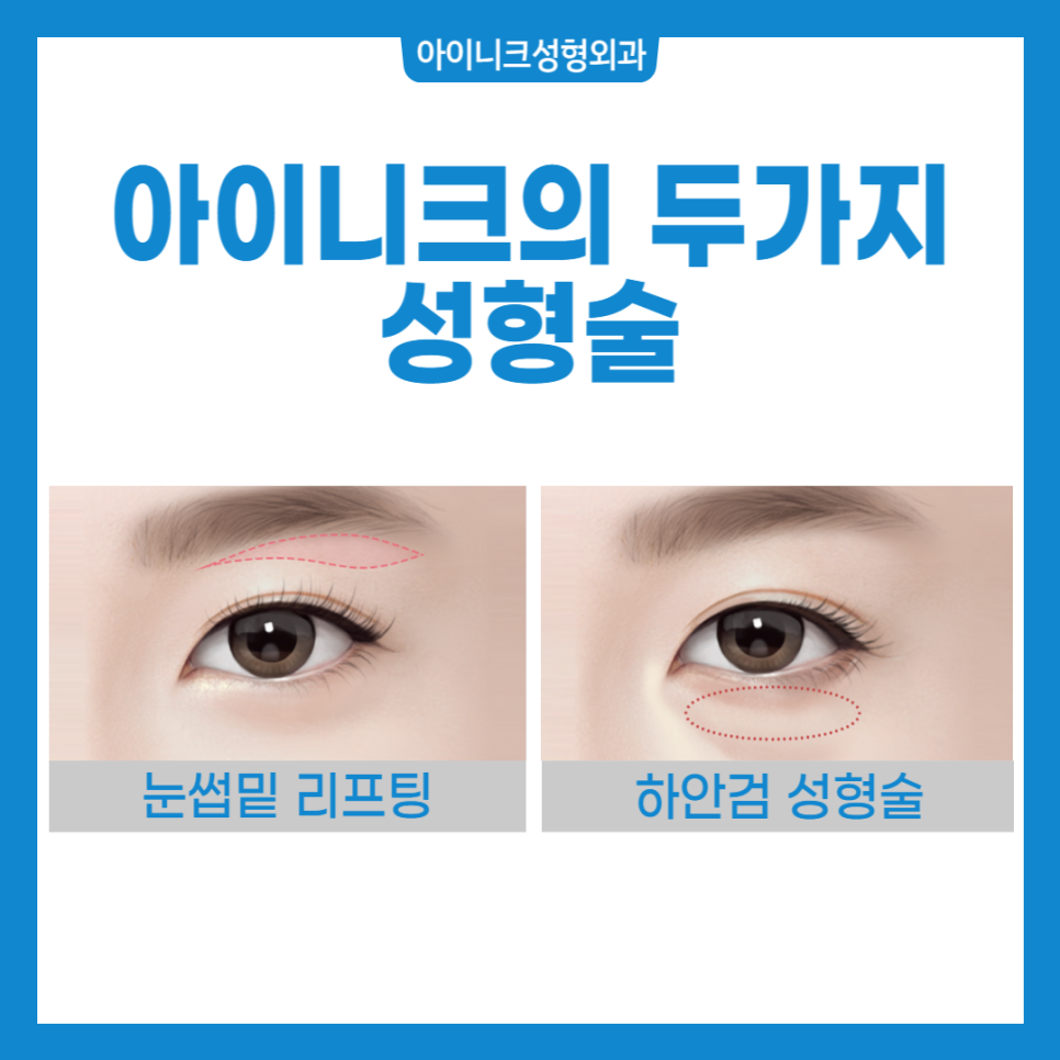 Sagging Eye Surgery: Just Remember These Two Things! image 2